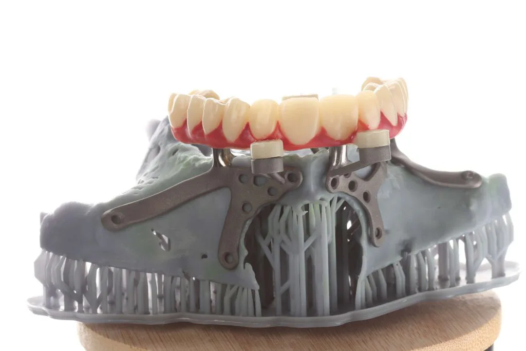 Custom implant clinical workflow