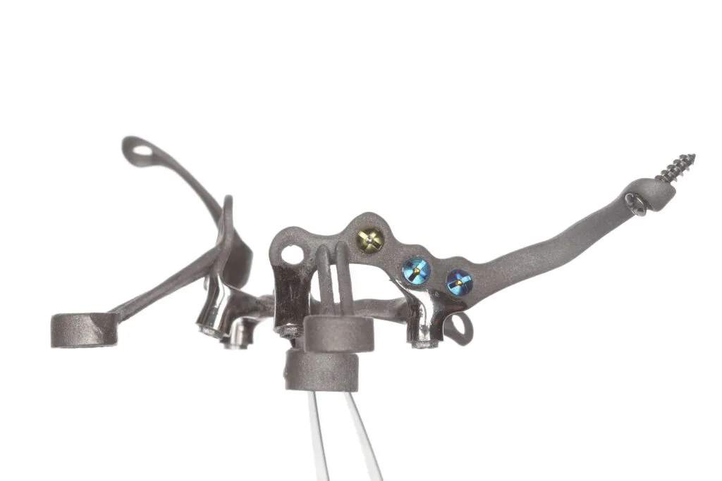 Custom implant framework simulation