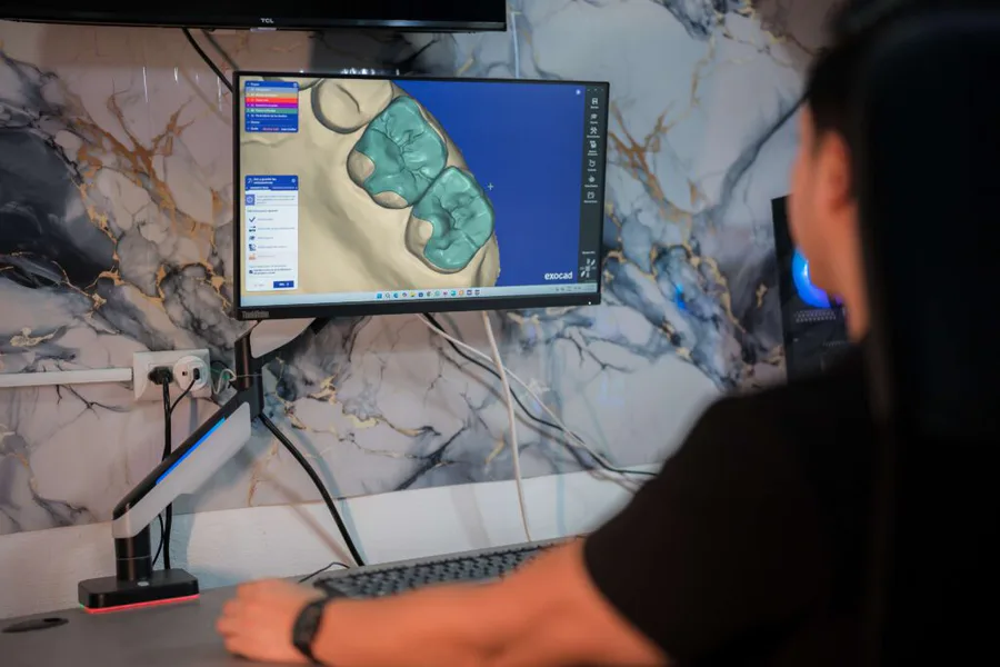Restauración dental diseñada digitalmente en pantalla