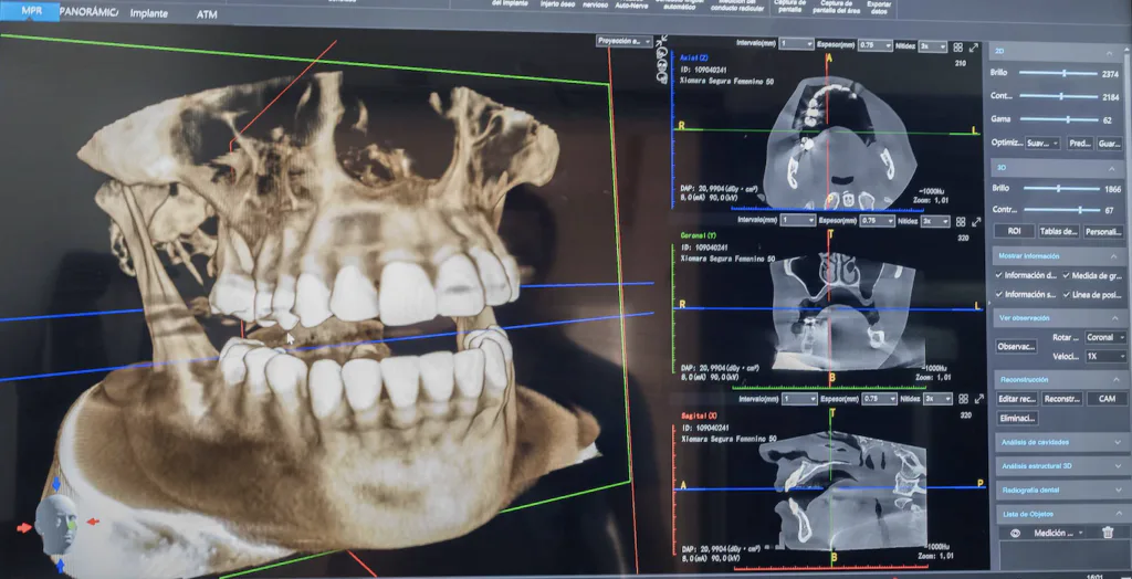Virtual implant position planning